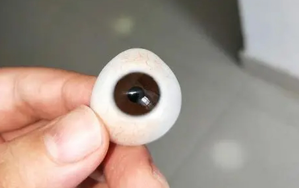佩戴义眼之前的检查